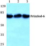 FZD6 Polyclonal Antibody