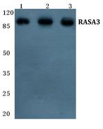 RASA3 Polyclonal Antibody