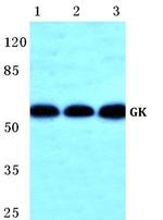 Glycerol kinase Polyclonal Antibody