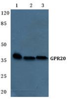 GPR20 Polyclonal Antibody