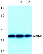 GPR41 Polyclonal Antibody
