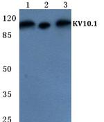 KCNH1 Polyclonal Antibody