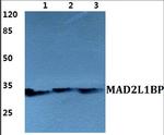 MAD2L1BP Polyclonal Antibody