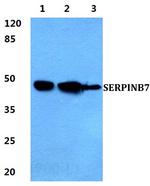 SERPINB7 Polyclonal Antibody