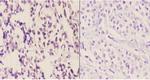 NDUFS1 Polyclonal Antibody