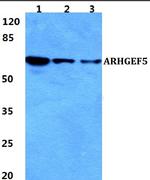 GEF5 Polyclonal Antibody