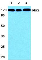 ORC1 Polyclonal Antibody