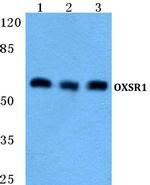 OXSR1 Polyclonal Antibody