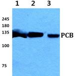Pyruvate Carboxylase Antibody in Western Blot (WB)