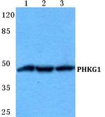 PHKG1 Polyclonal Antibody