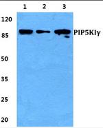 PIP5K1C Polyclonal Antibody