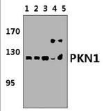PKN1 Polyclonal Antibody