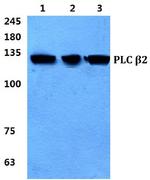PLCB2 Polyclonal Antibody