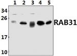 RAB31 Polyclonal Antibody