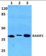 RASSF2 Polyclonal Antibody