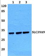 SLC39A9 Polyclonal Antibody