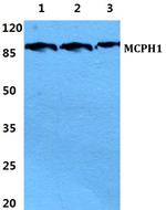 MCPH1 Polyclonal Antibody