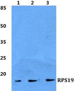 RPS19 Polyclonal Antibody