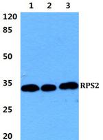 RPS2 Polyclonal Antibody
