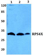 RPS4X Polyclonal Antibody