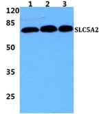 SGLT2 Polyclonal Antibody