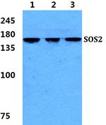 SOS2 Polyclonal Antibody