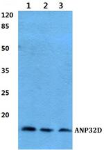 ANP32D Polyclonal Antibody