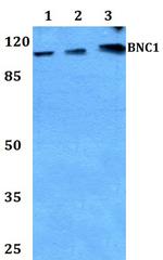 BNC1 Polyclonal Antibody