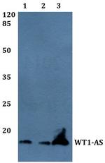 WT1-AS Polyclonal Antibody