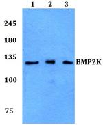 BIKE Polyclonal Antibody