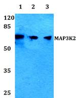 MEKK2 Polyclonal Antibody