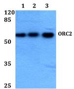 ORC2 Polyclonal Antibody