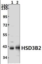 HSD3B2 Polyclonal Antibody