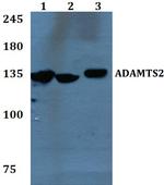 ADAMTS2 Polyclonal Antibody