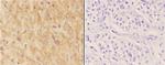 ASAH3 Polyclonal Antibody