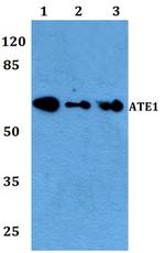 ATE1 Antibody in Western Blot (WB)