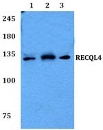 RECQ4 Polyclonal Antibody