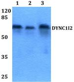 DYNC1I2 Polyclonal Antibody