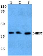 DHRS7 Polyclonal Antibody