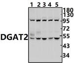 DGAT2 Polyclonal Antibody