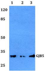 Connexin 31.1 Polyclonal Antibody