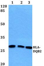 HLA-DQB2 Polyclonal Antibody