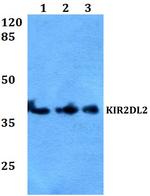 KIR2DL2 Polyclonal Antibody