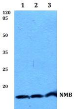 NMB Polyclonal Antibody