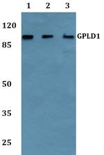 GPLD1 Polyclonal Antibody