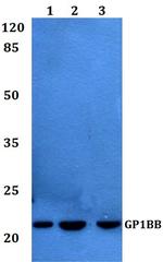 GP1BB Polyclonal Antibody