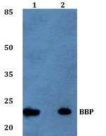 TM2D1 Polyclonal Antibody