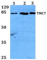 TMC7 Polyclonal Antibody