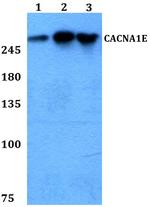 CaV2.3 Polyclonal Antibody