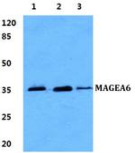 MAGEA6 Polyclonal Antibody